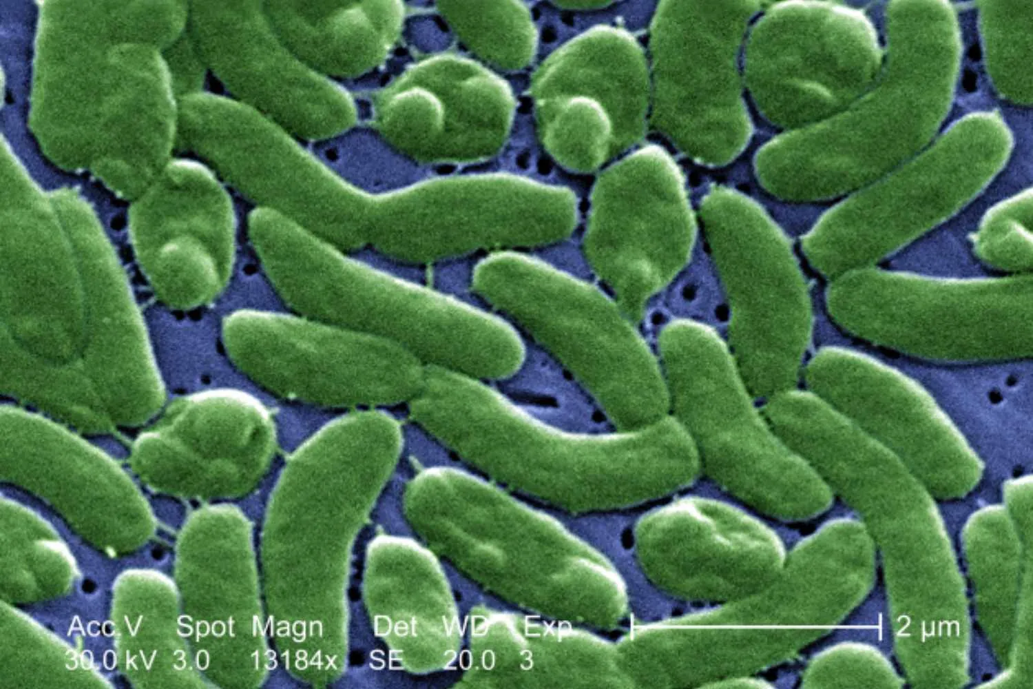 Con il mare sempre più caldo prolifera il temuto batterio "mangia-carne": la crisi climatica si espone a nuove infezioni