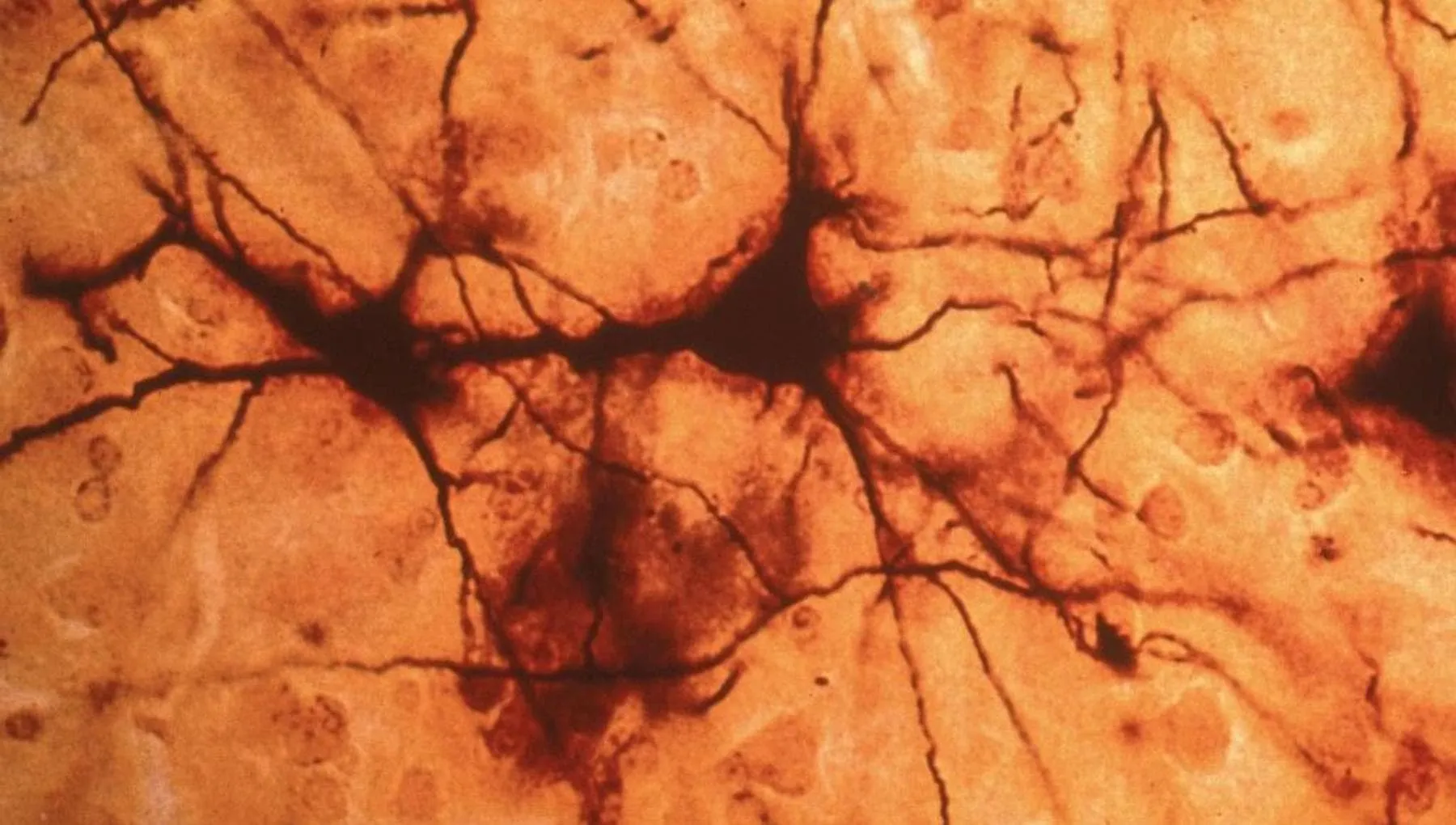 Dallo studio dei neuroni strategie per migliorare la memoria dell’intelligenza artificiale