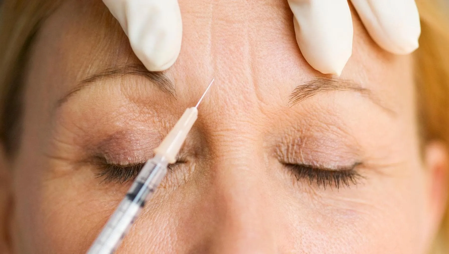 ‘Punturine’, rischio depressione e abuso se si fanno per farci accettare dagli altri