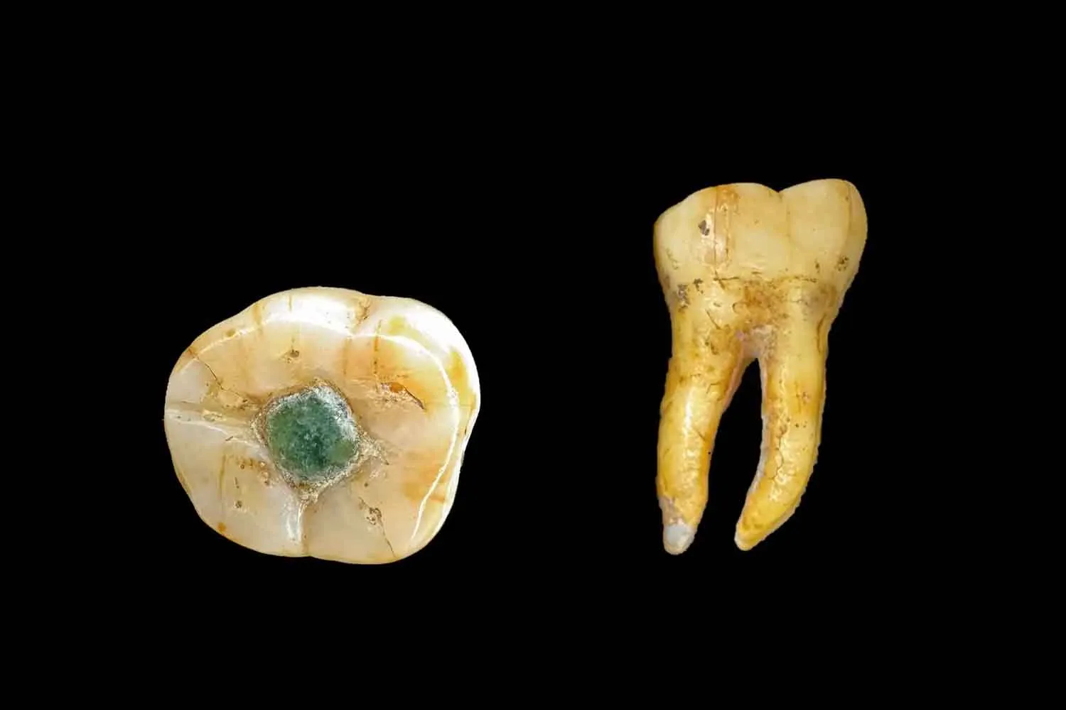 I Maya già sapevano otturare i denti in maniera accurata e... preziosa!