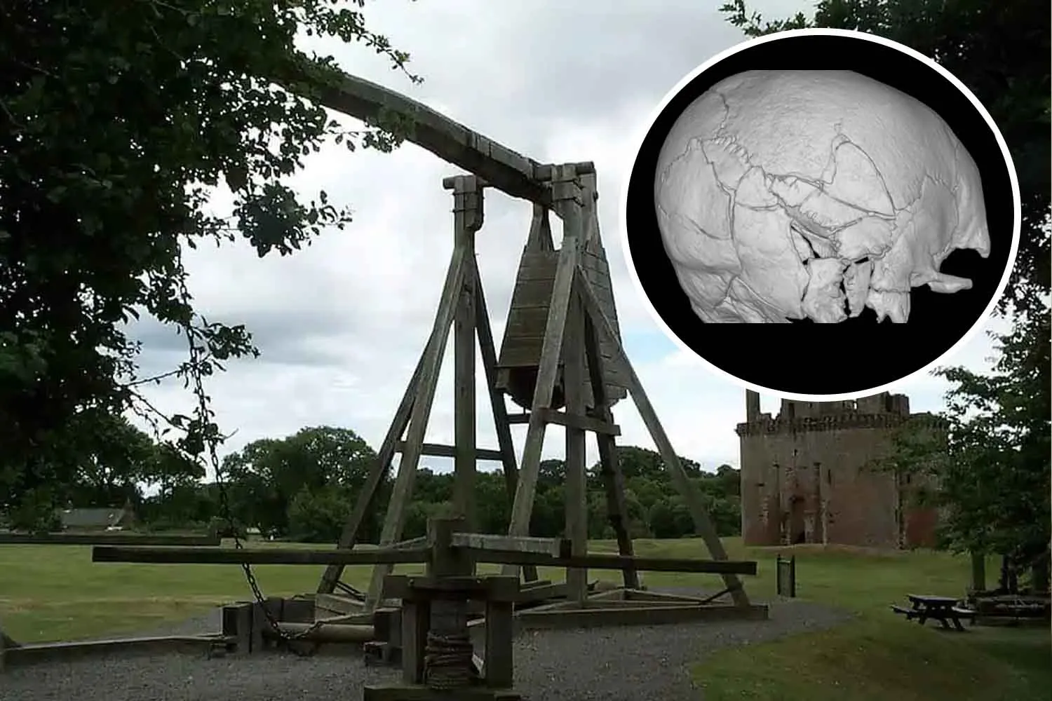 Questo scheletro risalente al Medioevo ha ben 167 fratture: potrebbe essere la prima vittima di una catapulta