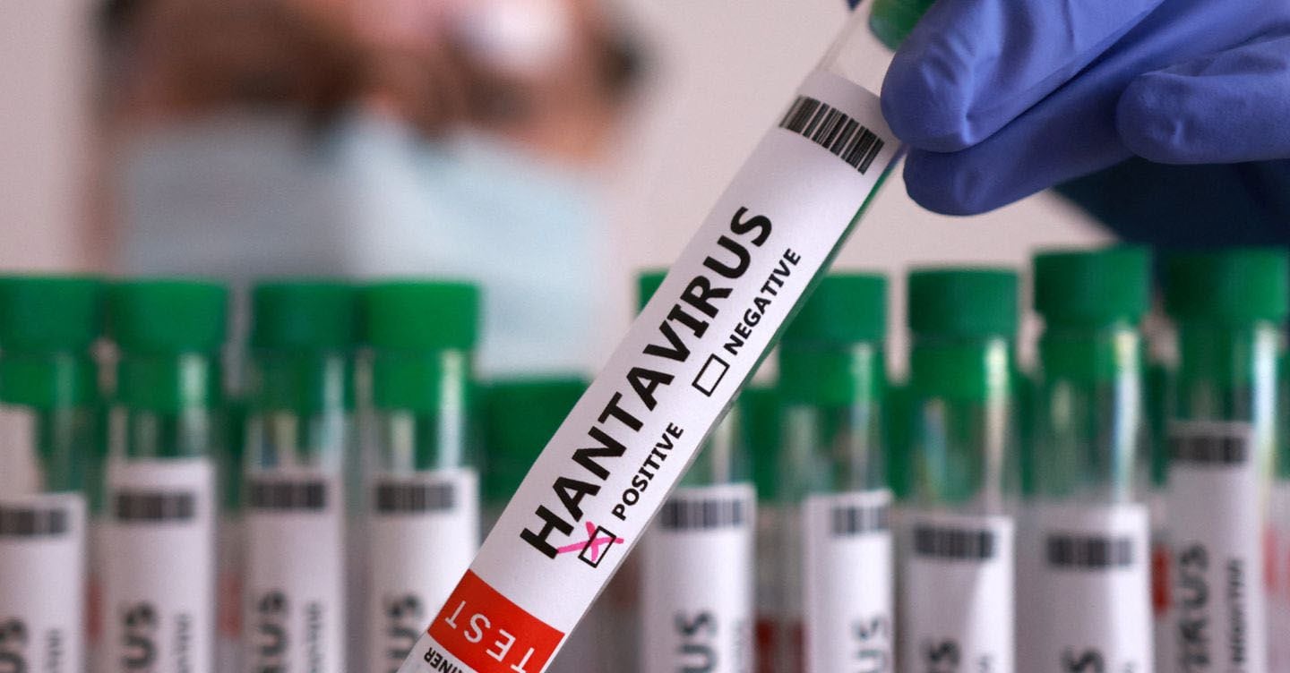 Hantavirus, cresce l'allarme. L'Oms: non è una pandemia, ma possibili altri contagi