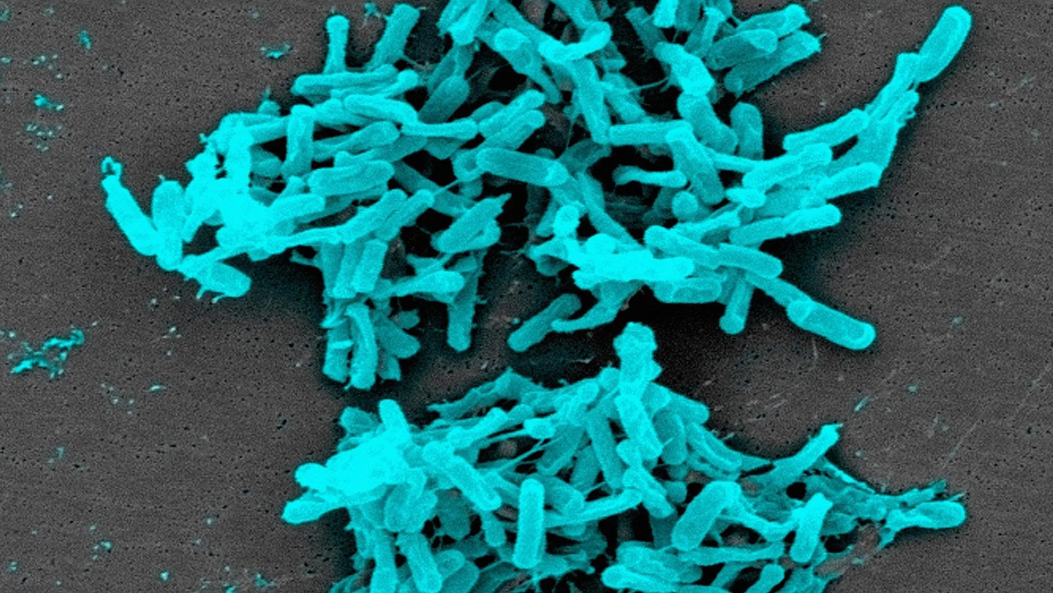 Catanzaro, ipotesi Clostridium difficile: come ci si contagia e qual è la cura