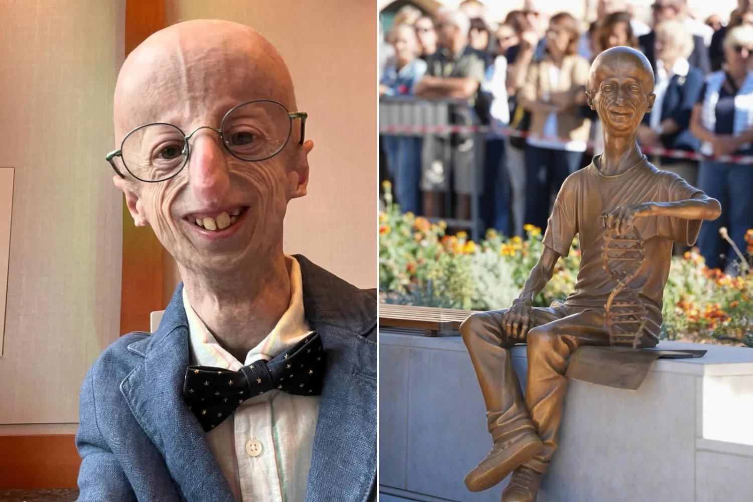 Due anni senza il sorriso di Sammy Basso: Bassano del Grappa gli dedica una statua e un Belvedere nel cuore della città