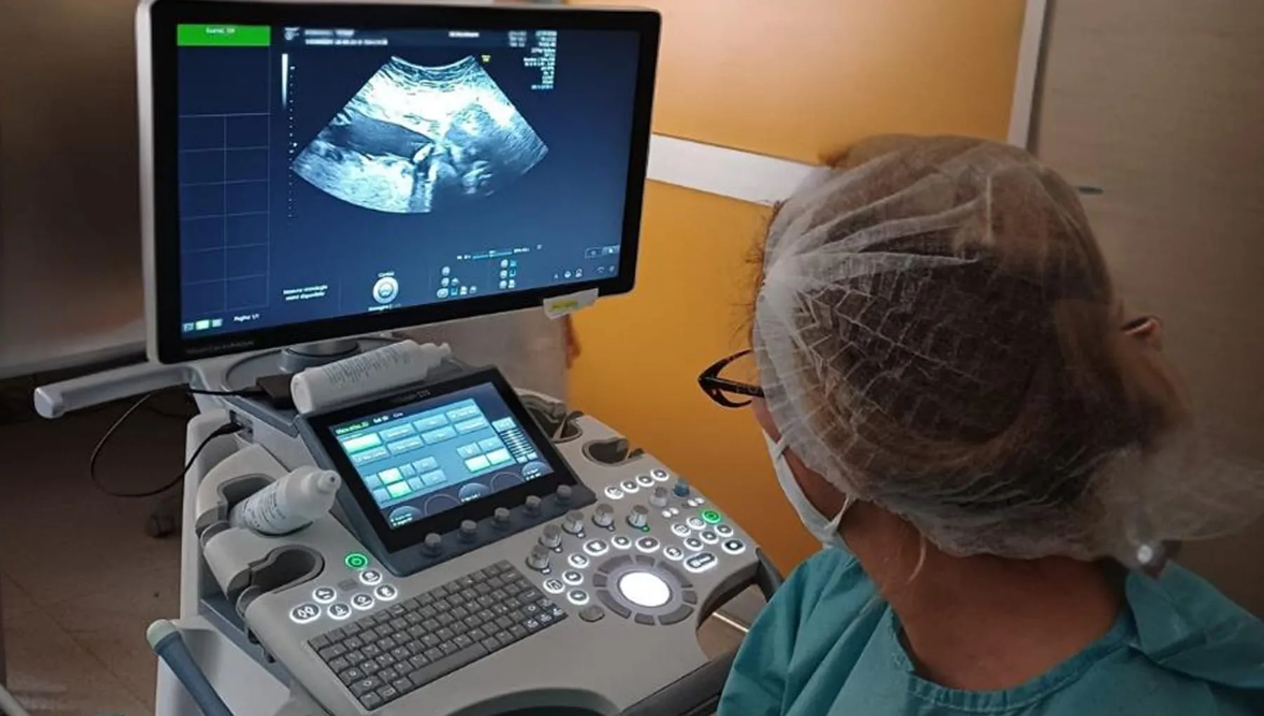 Displasia ectodermica ipoidrotica: al Policlinico di Milano il primo trattamento in utero in Italia