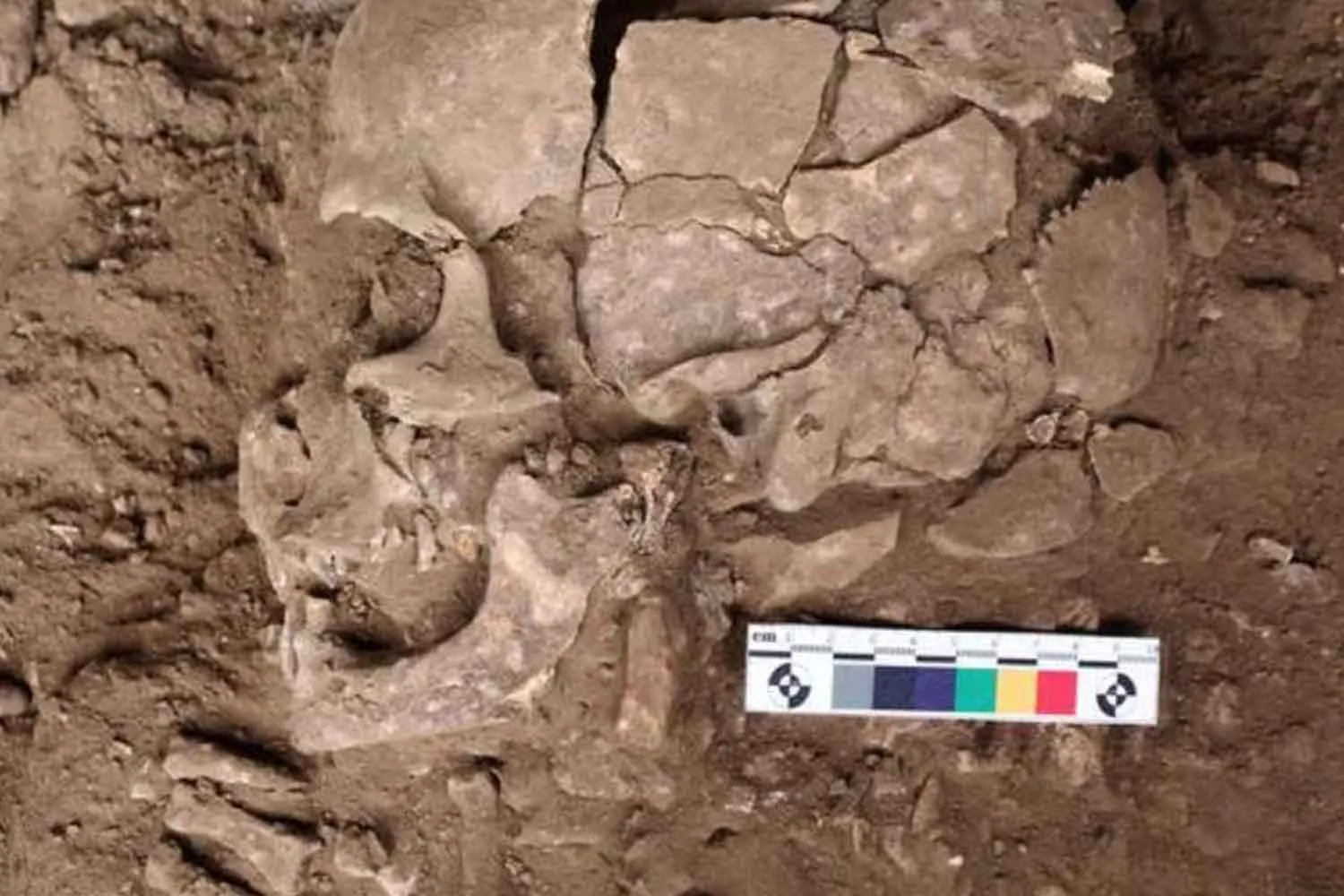La più antica prova di uso di sostanze psicoattive potrebbe essere nascosta in questi denti di 25.000 anni fa